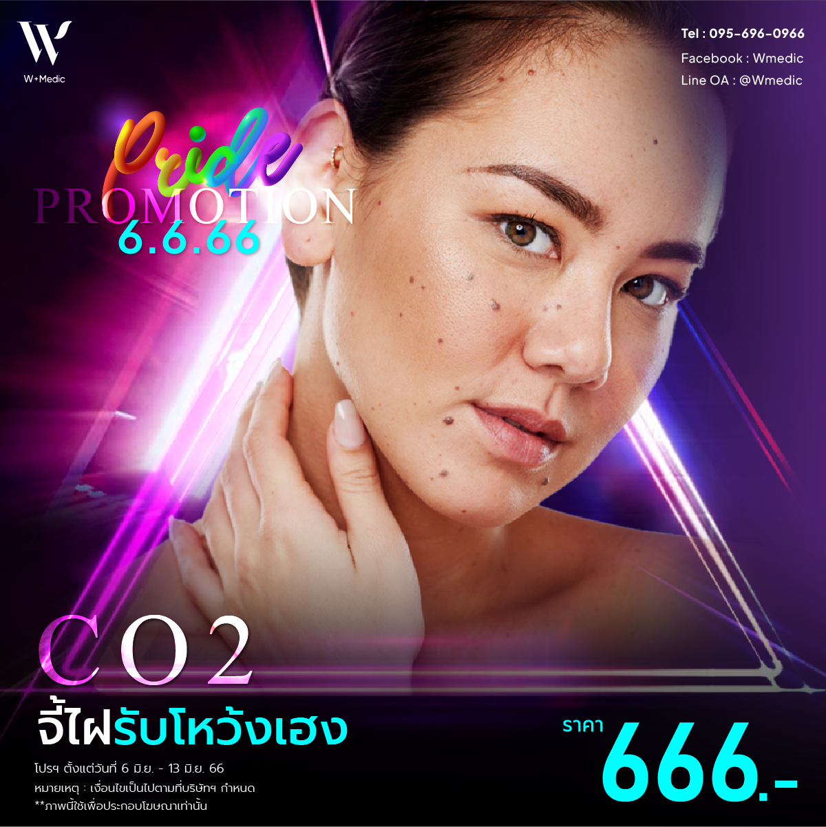 CO2 จี้ไฝรับโหว้งเฮง