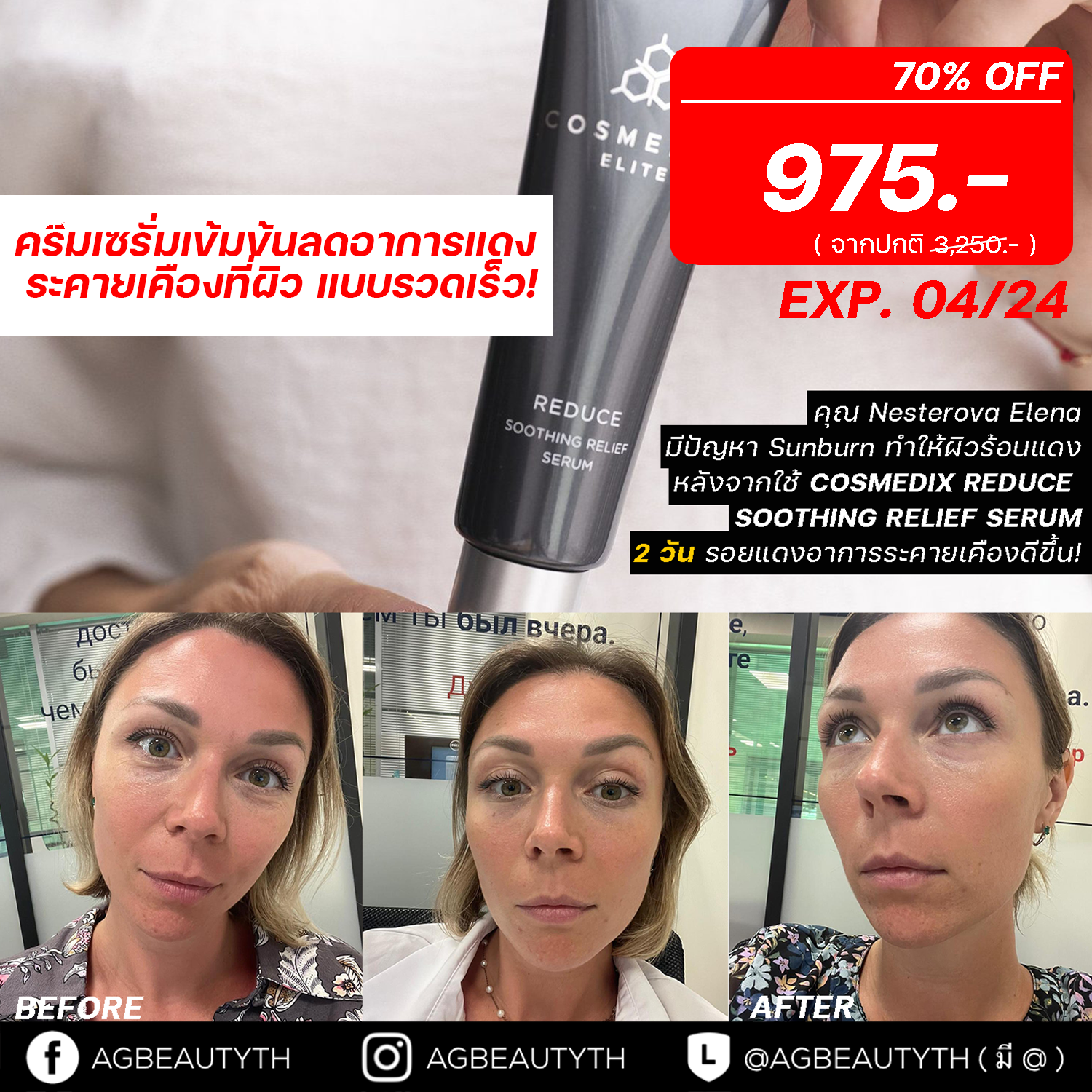 Cosmedix Elite Reduce Soothing Relief Serum  ( EXP 04/2024 )
