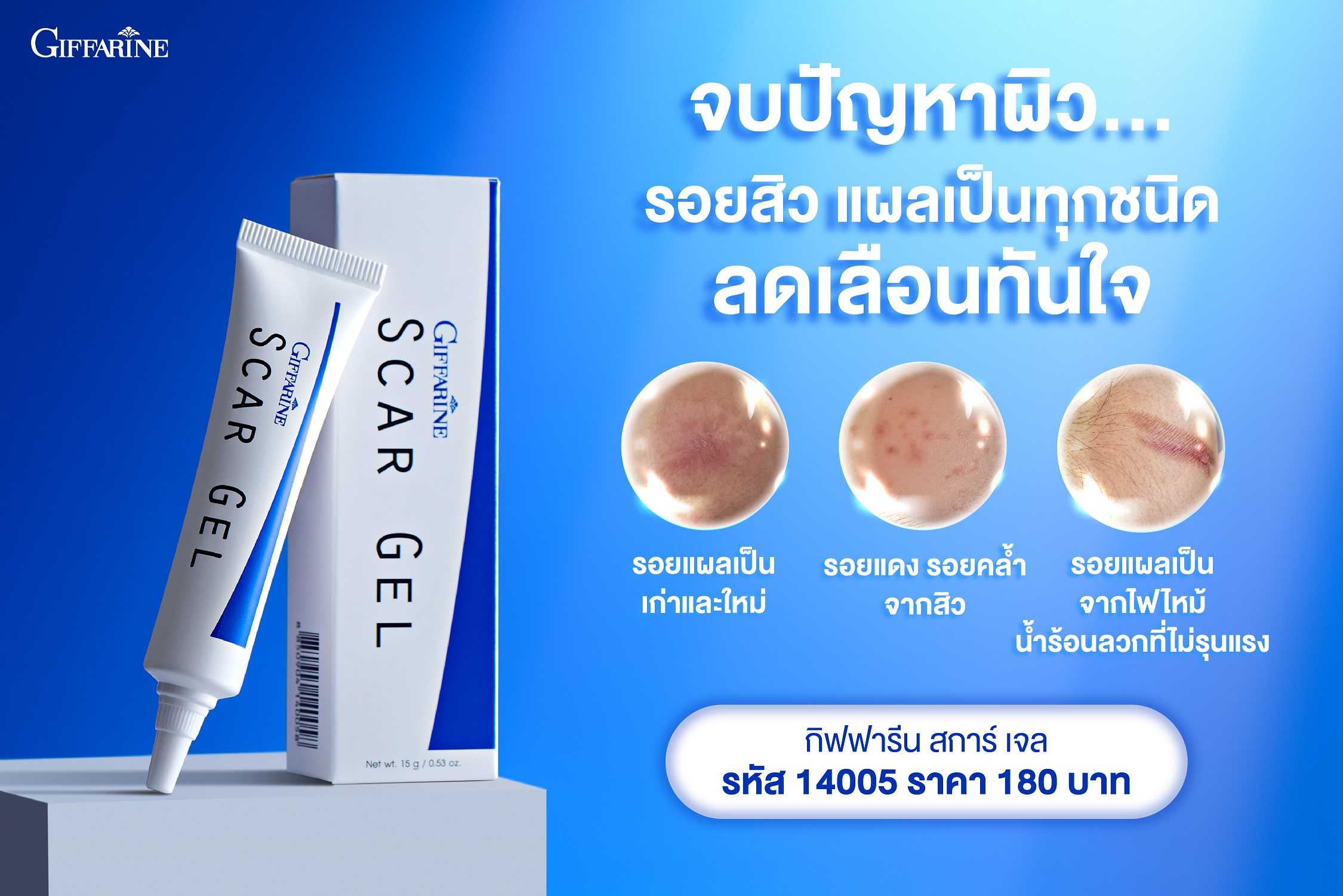 กิฟฟารีน สการ์ เจล Scar Gel Giffarine รักษารอยดำ รอยแดง รอยหลุมสิว รอยแผลเป็น