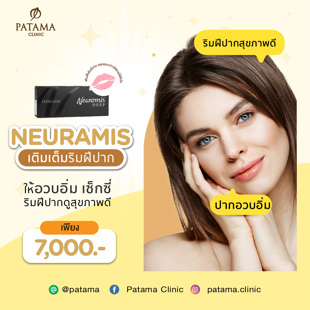 Neuramis (lip)