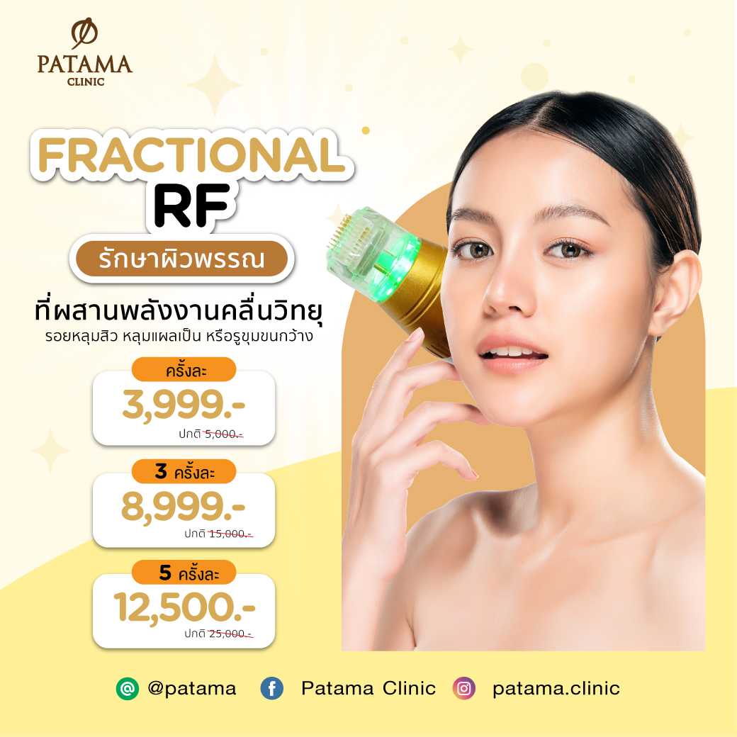 Fractional RF MicroNeedling