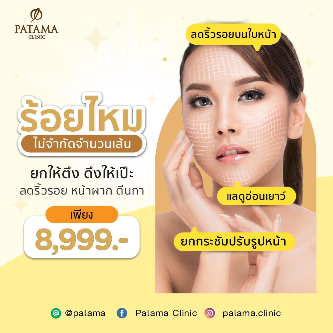 ร้อยไหม