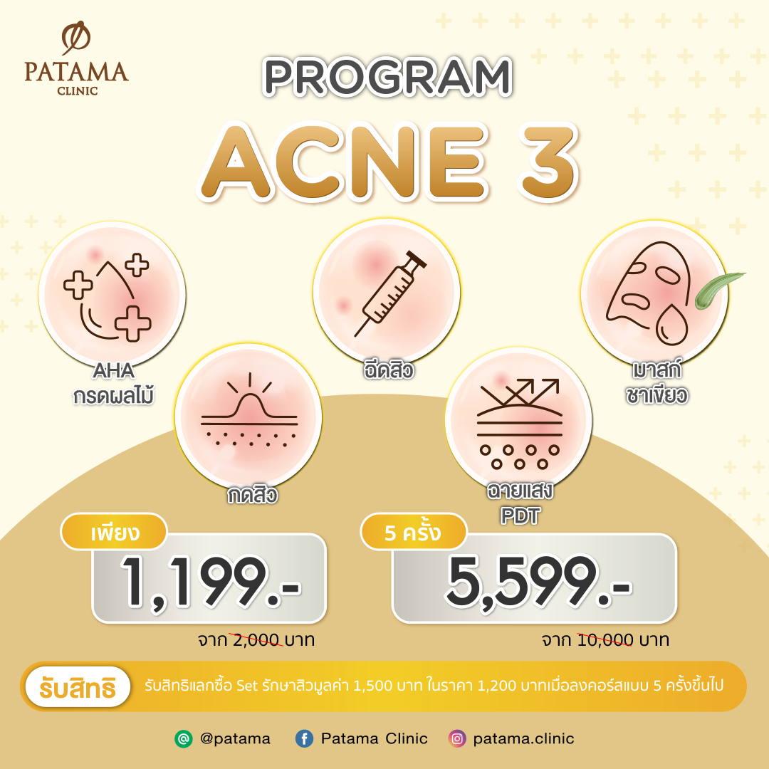 ACNE 3