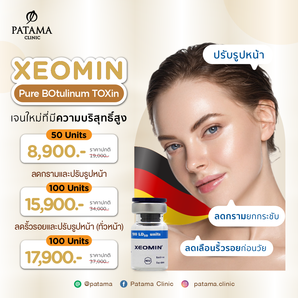 Xeomin Botox