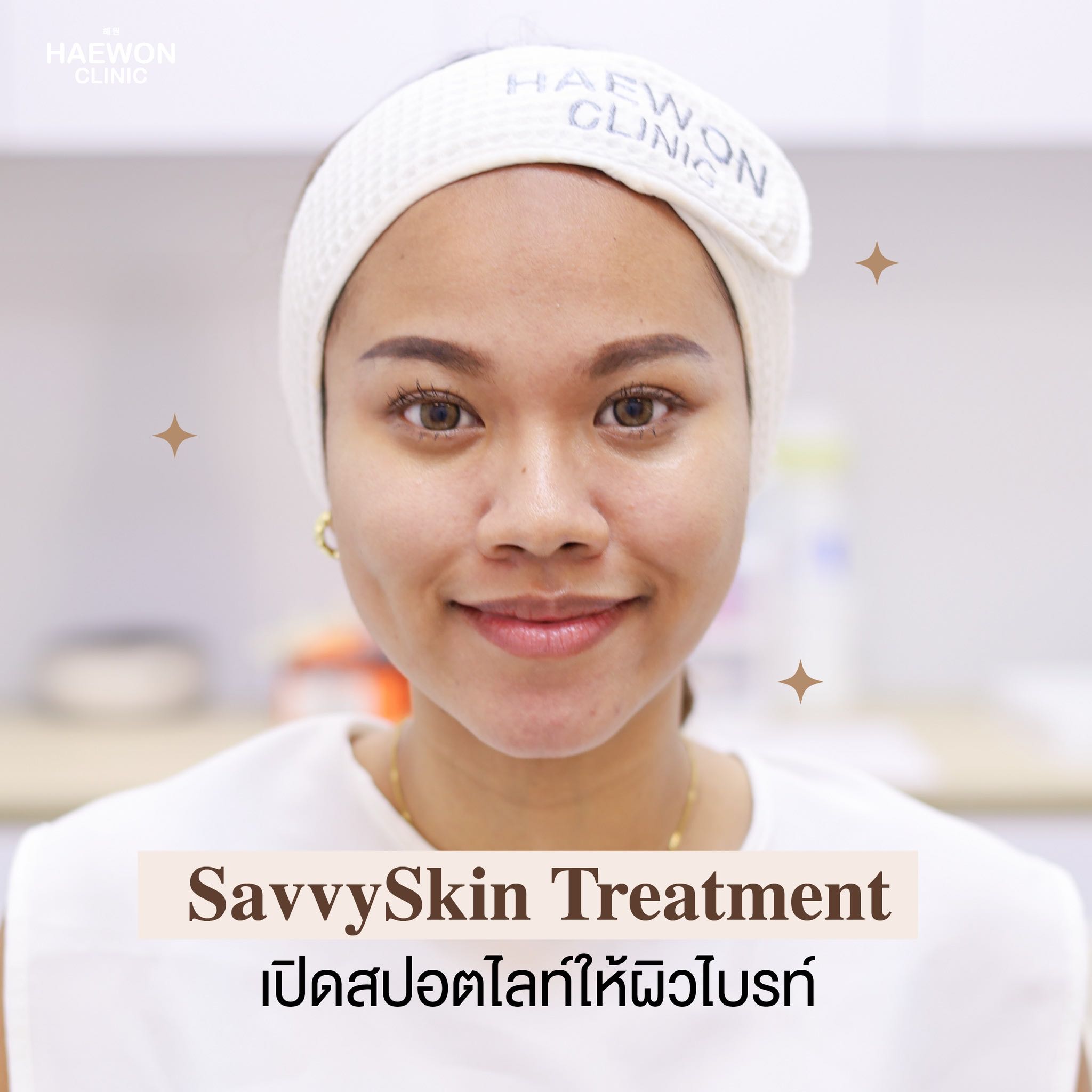 เปิดสปอตไลท์ให้ผิวไบรท์ด้วย SavvySkin Treatment