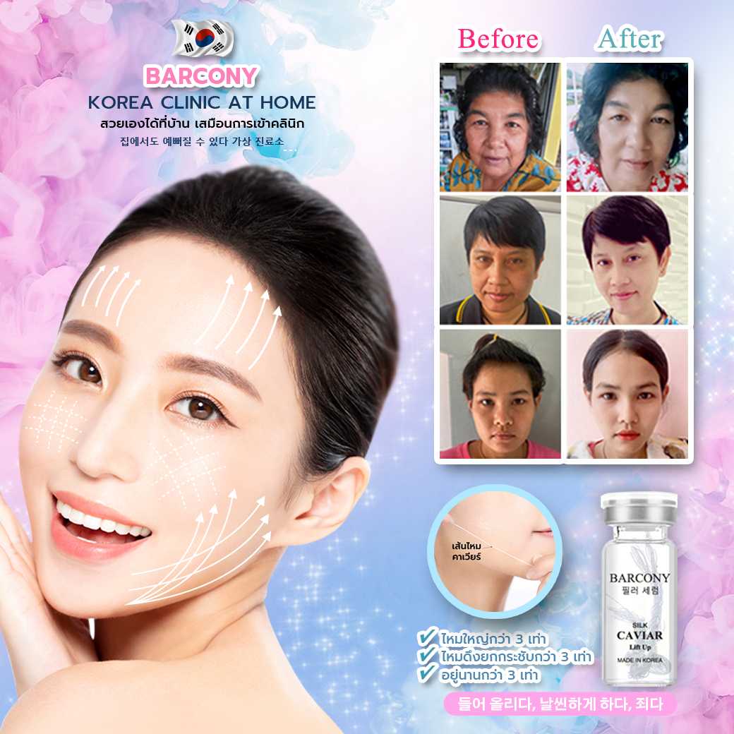 Barcony โปรแกรมร้อยไหมเกาหลียกหน้าตึง ดึงหน้าเอง แบบไม่เจ็บตัว ยกหน้า V-Shape
