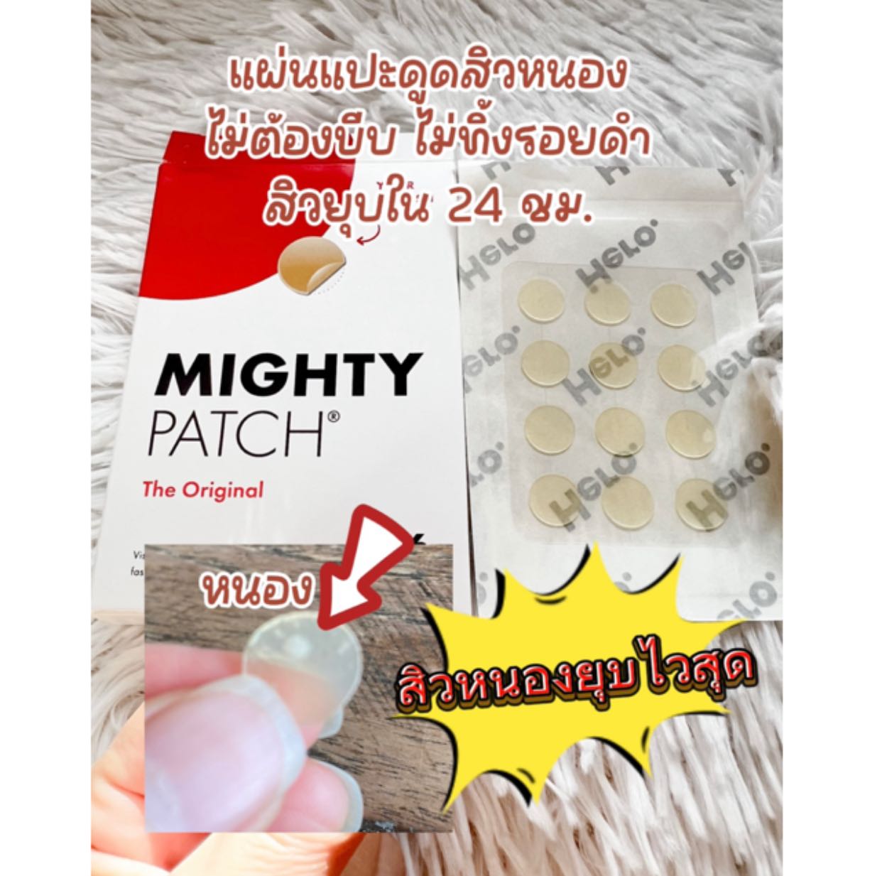 Hero Cosmetics  Mighty Patch  The Original มี 36 แผ่น ขนาด 12 m