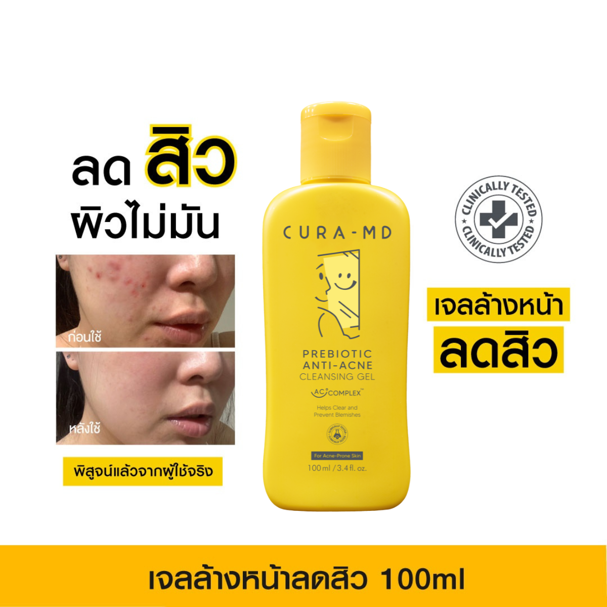 CURA-MD Prebiotic Anti-Acne Cleansing Gel คูร่า-เอ็มดี พรีไบโอติก แอนไท-แอคเน่ คลีนซิ่งเจล 100มล.